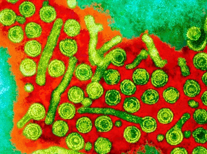 Image: Colored transmission electron micrograph (TEM) of Hepatitis B viruses (large green circles), a cause of liver inflammation (Photo courtesy of Dr. Linda Stannard, UCT).